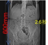 高速撮影